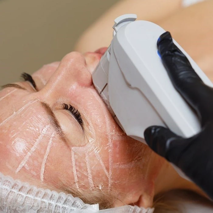 هایفوتراپی چیست؟ 1 هایفوتراپی چیست