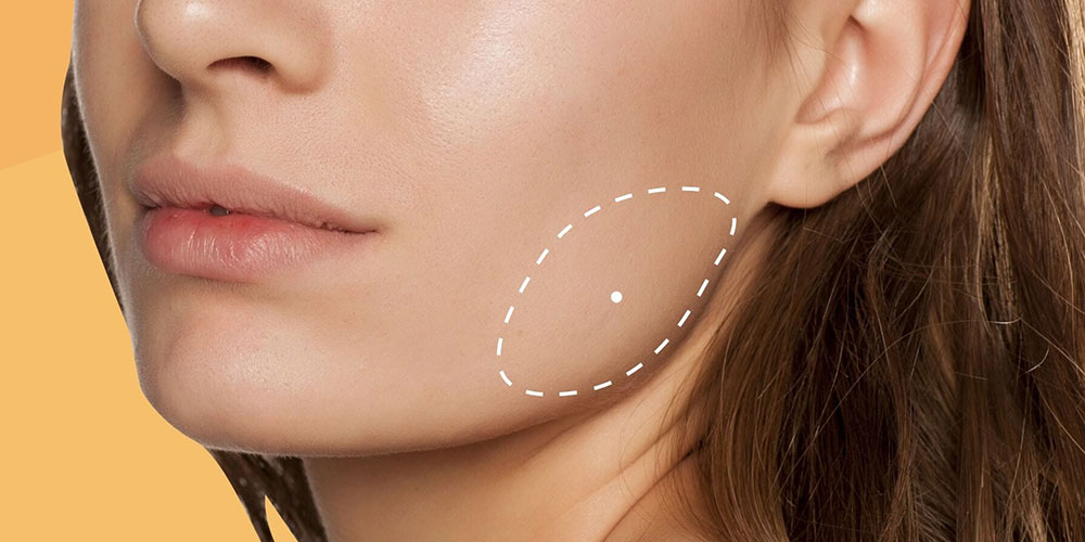 تخلیه بوکال فت چطور انجام میشود؟ عوارض آن چیست 1 تخلیه بوکال فت چیست