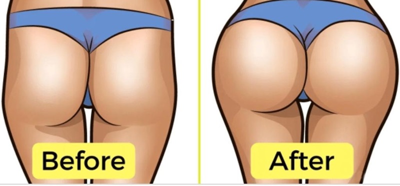 تزریق چربی به هیپ دیپ : یک رویکرد نوین 1 تزریق چربی به هیپ دیپ