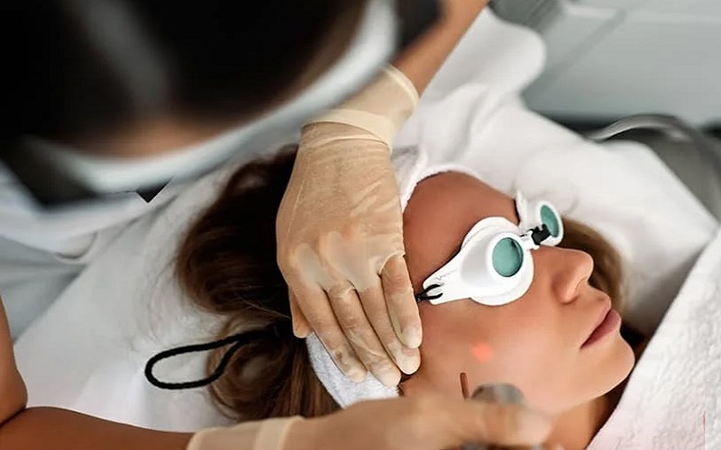 بهترین دستگاه لیزر موهای کرکی: راهنمای جامع برای حذف موهای نازک 1 بهترین دستگاه لیزر برای موهای کرکی