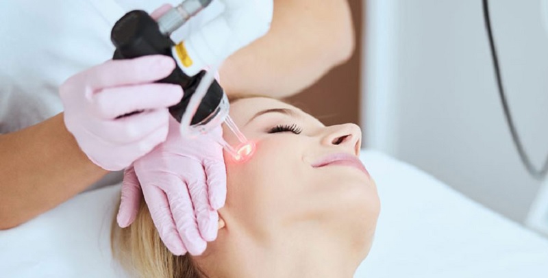 بهترین دستگاه لیزر موهای کرکی: راهنمای جامع برای حذف موهای نازک 2 نکاتی برای لیزر موهای نازک