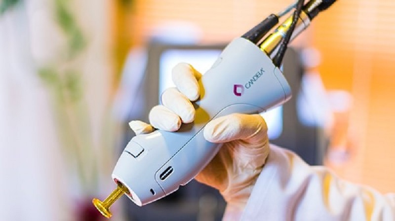 لیزر شاتی یا رولی؟ کدام برای حذف موهای زائد مناسب تر است؟ 1 لیزر شاتی