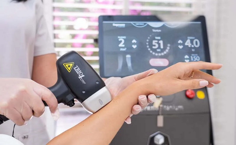 لیزر شاتی یا رولی؟ کدام برای حذف موهای زائد مناسب تر است؟ 2 لیزر رولی