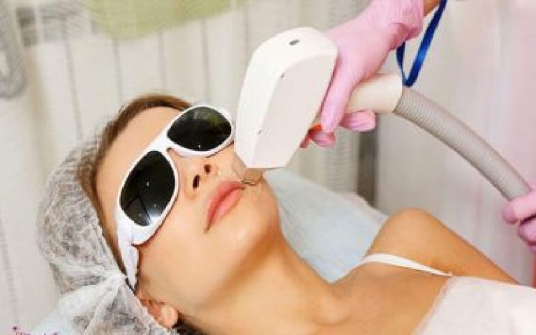 دانستنی های لازم در مورد لیزر موهای زائد