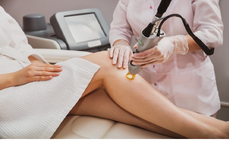 10 تا از دانستنی های لازم در مورد لیزر موهای زائد 1 مزایای لیزر موهای زائد