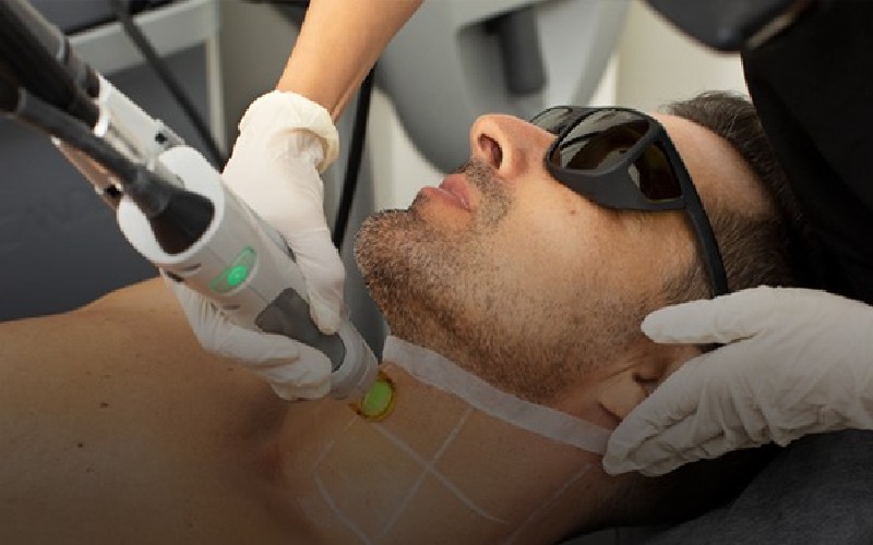 تعداد شات های لیزر برای نواحی مختلف بدن چقدر است؟ 1 تعداد شاتهای لیزر: چه عواملی بر آن تأثیر میگذارند