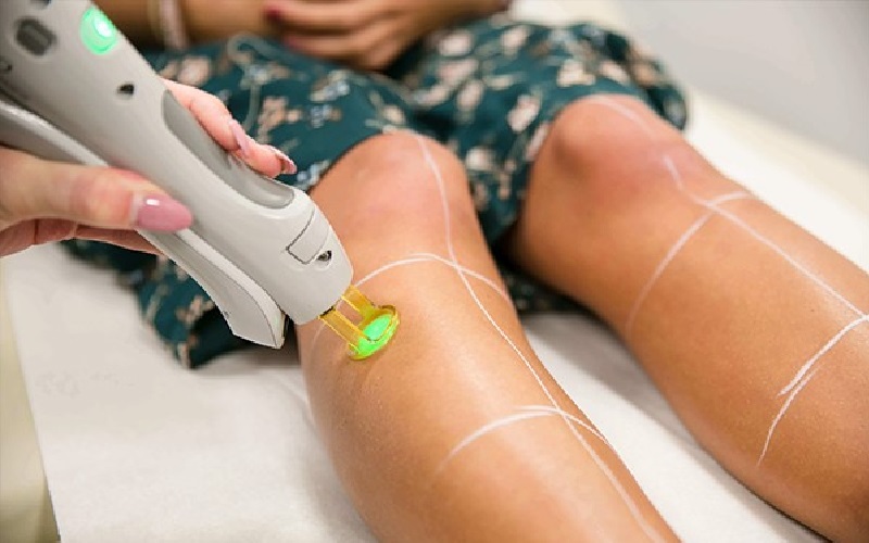 تعداد شات های لیزر برای نواحی مختلف بدن چقدر است؟ 2 تعداد شاتهای لیزر برای نواحی مختلف بدن