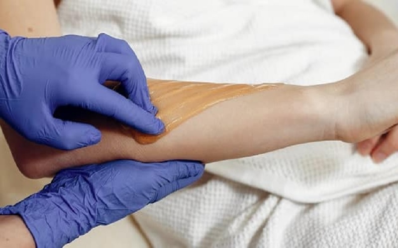 7 تا از روش های حذف موهای زائد: مزایا، معایب و انتخاب مناسب برای شما 2 وکس موهای زائد