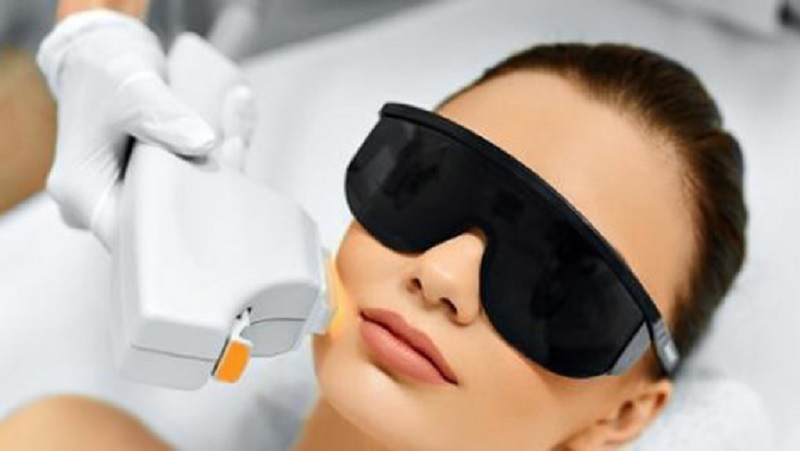 7 تا از روش های حذف موهای زائد: مزایا، معایب و انتخاب مناسب برای شما 7 لیزر IPL