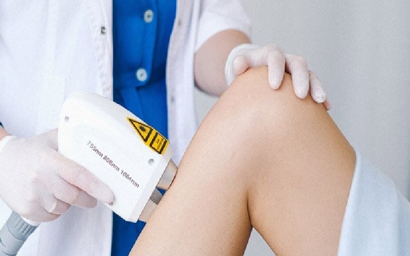 اپیلاسیون یا لیزر، کدام بهتر است؟ 2 مزایا و معایب اپیلاسیون