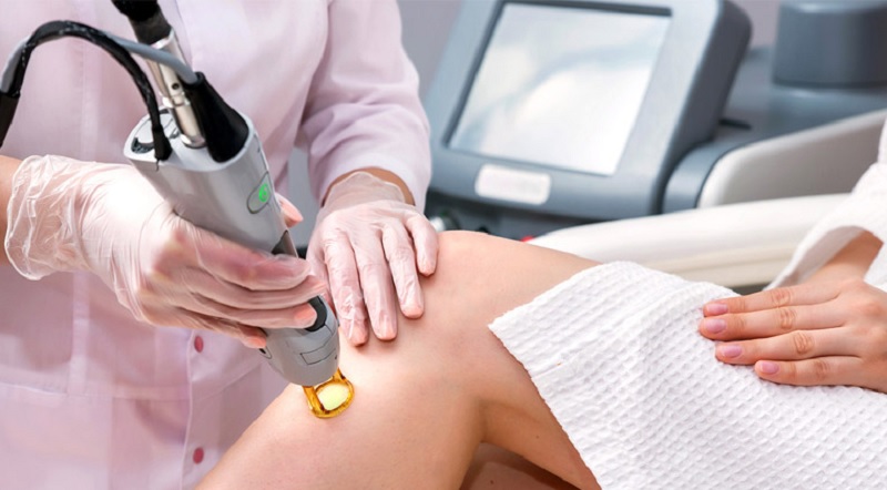 بهترین دستگاه لیزر برای پوست روشن کدام است؟ (معرفی 4 دستگاه) 1 لیزر الکساندرایت