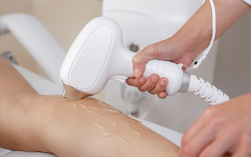 دستگاه لیزر با ژل یا بدون ژل؛ کدام بهتر است؟ 1 لیزر با ژل