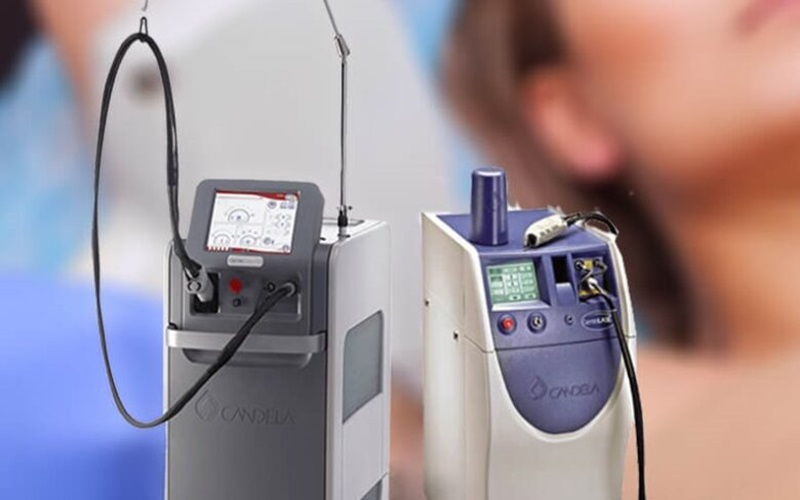 انواع دستگاه لیزر کندلا: راهنمای جامع برای انتخاب دستگاه مناسب برای درمان موهای زائد 2 دستگاه لیزر کندلا