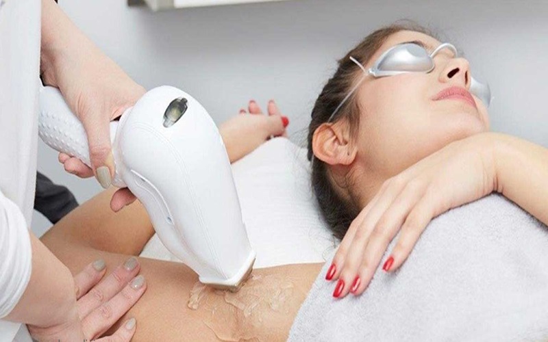 لیزر فول بادی چیست و چه قسمتهایی را شامل میشود؟ 1 لیزر فول بادی