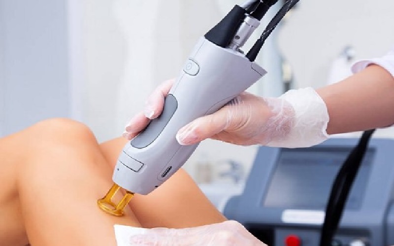 فواید و خطرات لیزر بیکینی: بررسی جامع 2 خطرات و عوارض جانبی لیزر بیکینی