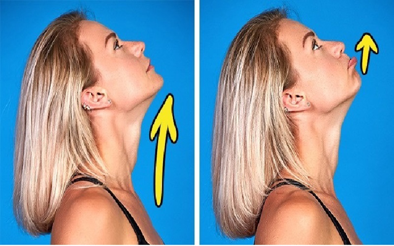 راههای لاغری صورت | چگونه چربی صورت را کاهش دهیم؟ 1 ایا لاغری صورت ممکن است