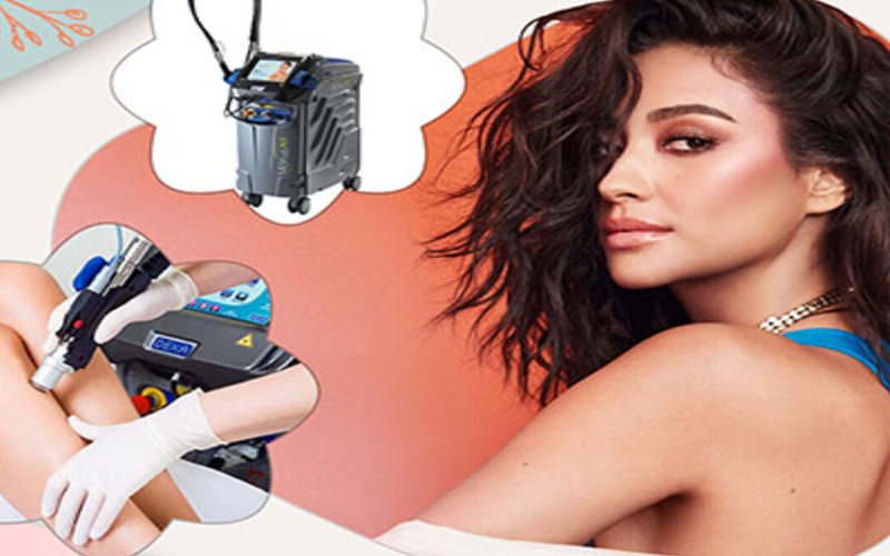 لیزر دکا بهتره یا کندلا؟ مقایسه کامل و راهنمای انتخاب 1 معرفی لیزر دکا