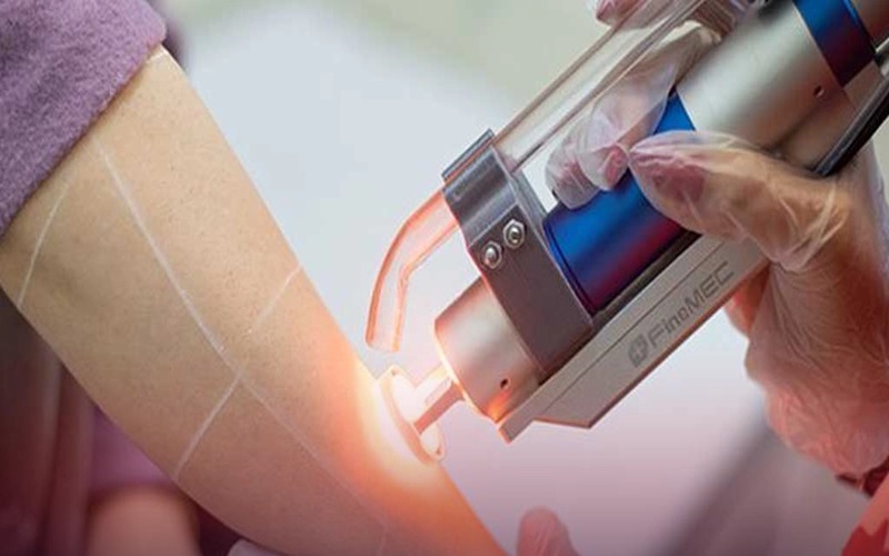 تفاوت دستگاه لیزر نابلکس و کندلا: مقایسه کامل برای انتخاب بهترین دستگاه لیزر 3 تفاوتهای اصلی دستگاههای لیزر نابلکس و کندلا