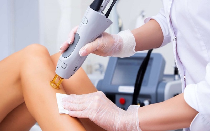 دستگاه لیزر کندلا بهتر است یا الکس؟ مقایسه دو فناوری لیزر برای درمان موهای زائد 2 دستگاه لیزر الکساندریت