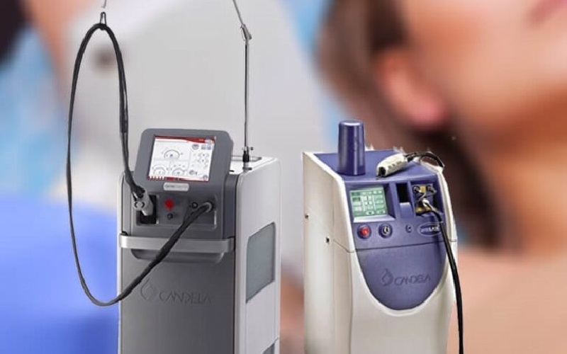 دستگاه لیزر کندلا بهتر است یا الکس؟ مقایسه دو فناوری لیزر برای درمان موهای زائد 3 تفاوت های کلیدی بین دستگاه لیزر کندلا و الکساندریت