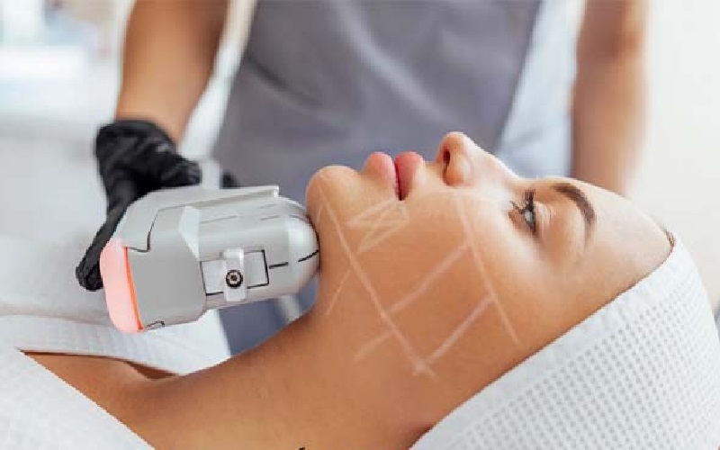 سریع ترین روش لاغری: معرفی 7 روش برتر 4 لاغری با هایفم (HIFU)