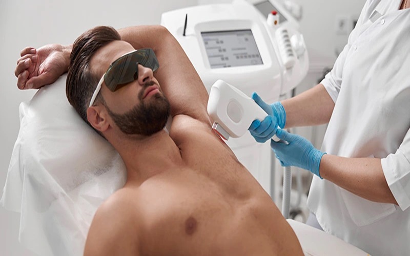 از بین بردن موهای زائد مردان برای همیشه: راهکارها، روشها و مزایا 4 مزایای لیزر موهای زائد برای مردان