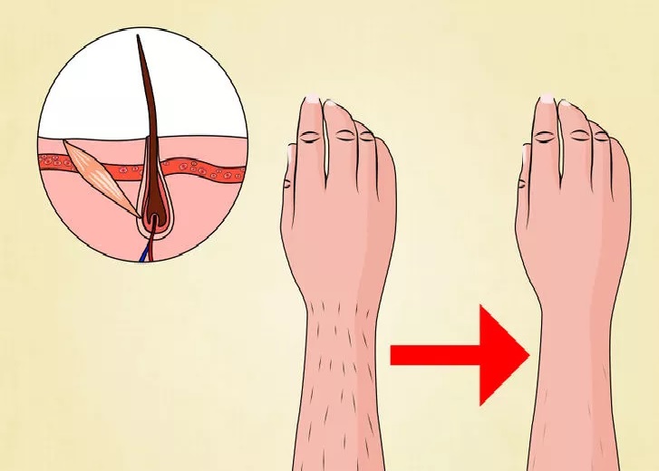 لیزر برای چه کسانی ممنوع است؟ 3 خ 6