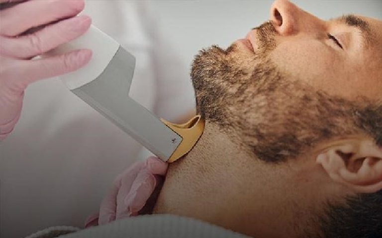 لیزر خط ریش برای آنکارد کردن صورت آقایان