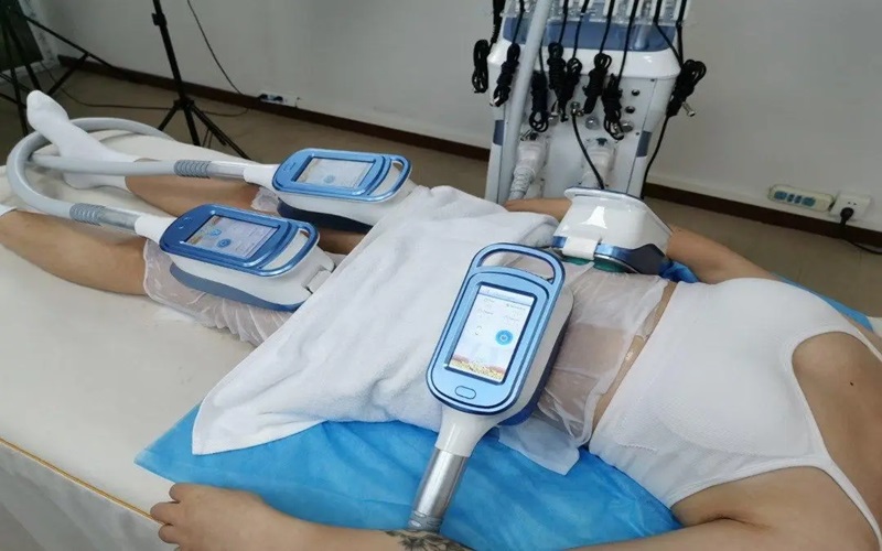 معرفی بهترین دستگاه های لاغری | راهنمای کامل لاغری موضعی با تکنولوژی روز 6 دستگاه کرایولیپولیز (CoolSculpting)