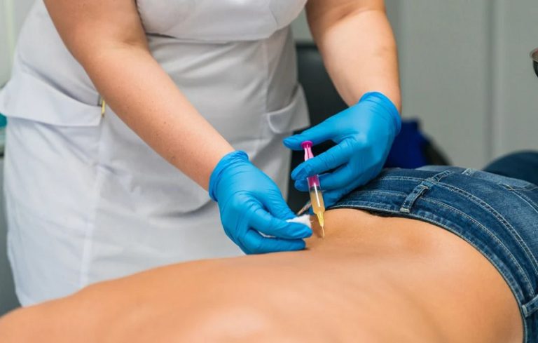 اوزون درمانی برای دیسک کمر