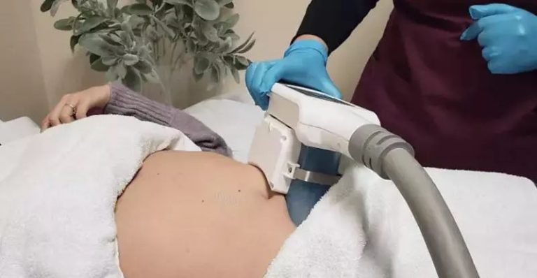 همه چیز درباره کول اسکالپتینگ الیت