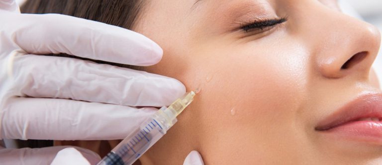 ماندگاری فیلر