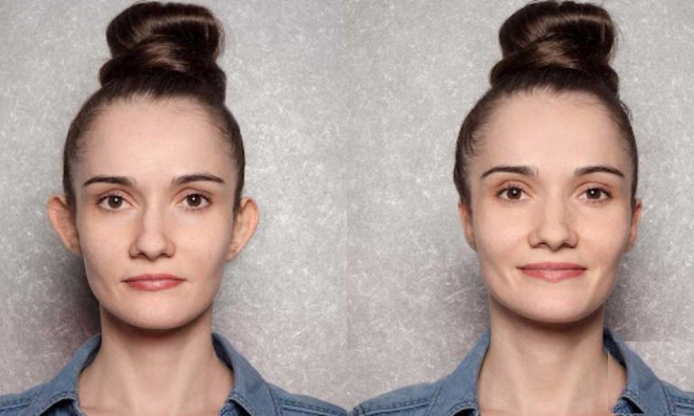 جراحی زیبایی گوش