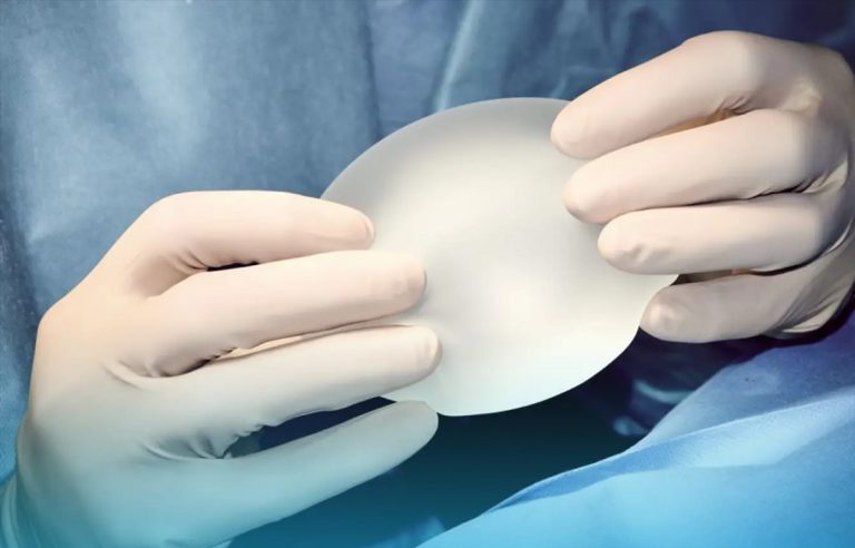 اقدامات قبل از عمل پروتز سینه