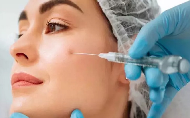 ژل گونه در اصفهان 1 22 1