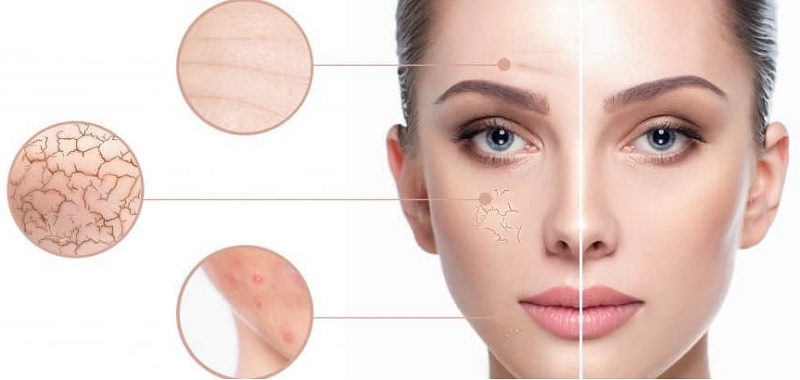 اسکن پوست در اصفهان 1 آنالیز پوست در اصفهان