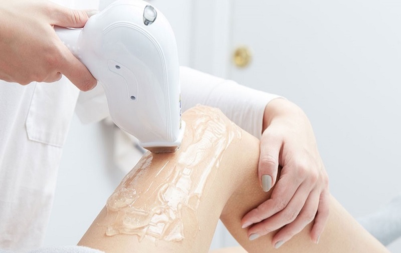 تفاوت IPL خانگی و لیزر موهای زائد 3 27 4