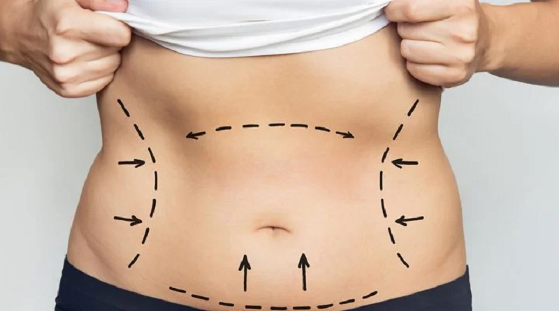 لیپوماتیک در اصفهان 1 لیپوماتیک در اصفهان