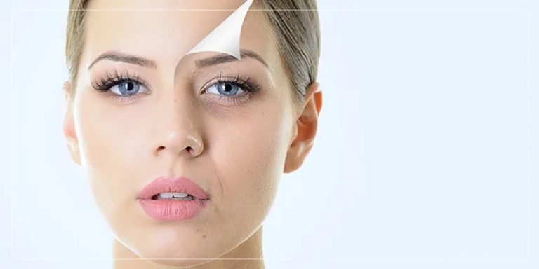 لایه برداری پوست