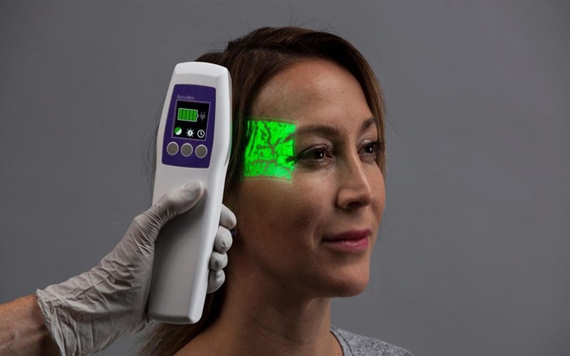 تشخیص دستگاه اسکنر پوست برای تشخیص لک 1 اااااااا