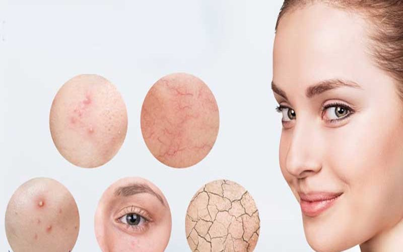 تشخیص دستگاه اسکنر پوست برای تشخیص لک 2 مزایای استفاده از دستگاه اسکنر