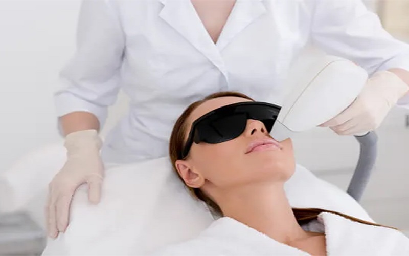 مدیریت تنبلی تخمدان با لیزر موهای زائد 1 بب