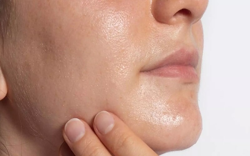 سالیسیلیک اسید: آیا برای درمان جوش موثر است؟ 2 روشهای استفاده از سالیسیلیک اسید