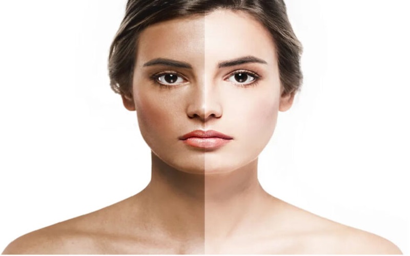 بهترین محصولات درمان جوش و روشهای مراقبت از پوست مستعد جوش 1 شناخت پوست مستعد جوش