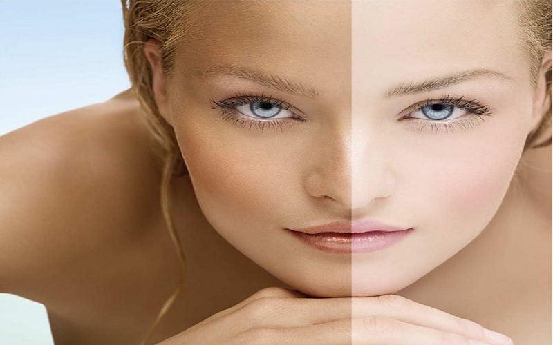 چرا نمیتوانید همزمان لیزر موهای زائد و آفتاب گرفتن را انجام دهید؟ 3 ثثثث 1