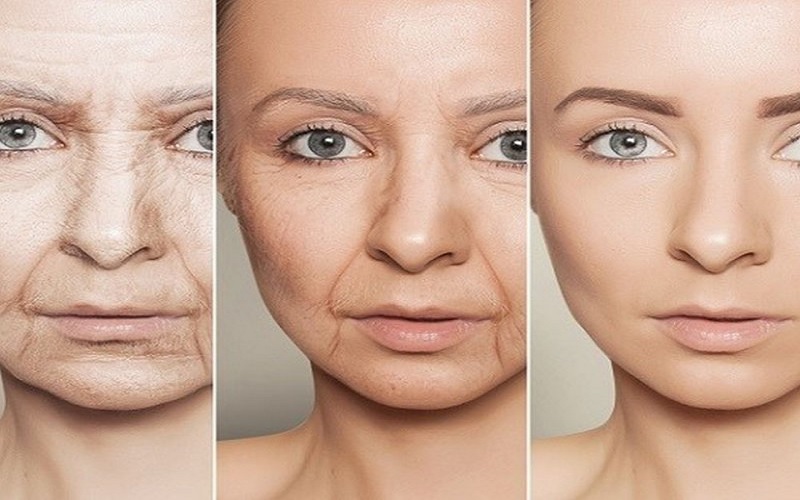 تاثیر وزن بر سلامت پوست 1 مشکلات رایج پوستی در افراد دارای اضافه وزن ؛ تاثیر وزن بر پوست