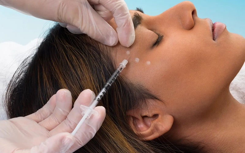 برترین درمانهای تزریقی برای جوانسازی پوست 3 فیلرهای اسکالپترا و نقش آنها در جوانسازی