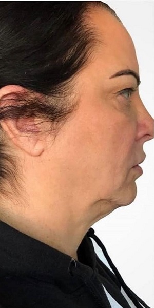 اندولیفت در اصفهان 7 11 1