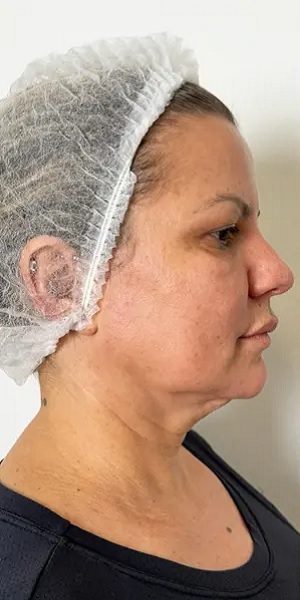 اندولیفت در اصفهان 3 4 3