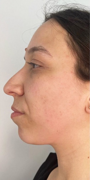 اندولیفت در اصفهان 5 6 3